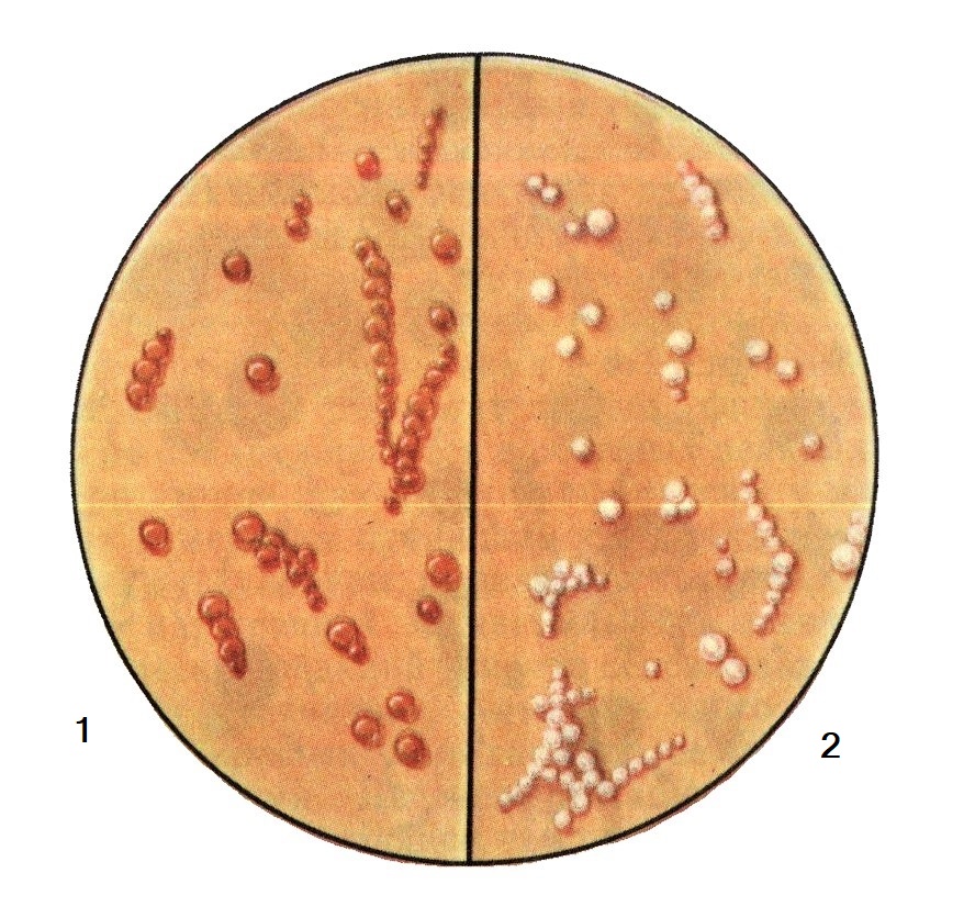 Staphylococcus aureus в носу. Золотистый стафилококк язвы. Сифилисный стафилококк. Стафилококк ауреус мазок. Дерматический стафилококк.