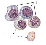 Группа макробластов и макроцит из костного мозга взрослого человека