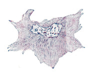 мезенхимальная ретикуло-эндотелиальная клетка.