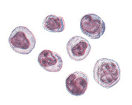 Группа лимфоцитов; справа сверху — лимфобласт.