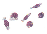 Паралимфоциты из крови при инфекционном лимфоцитозе