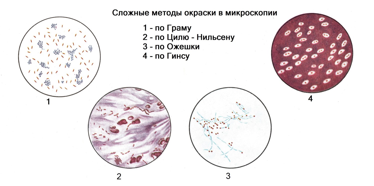 Сложные методы окраски в микроскопии