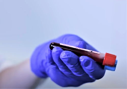 Основные принципы микроскопического исследования форменных элементов крови
