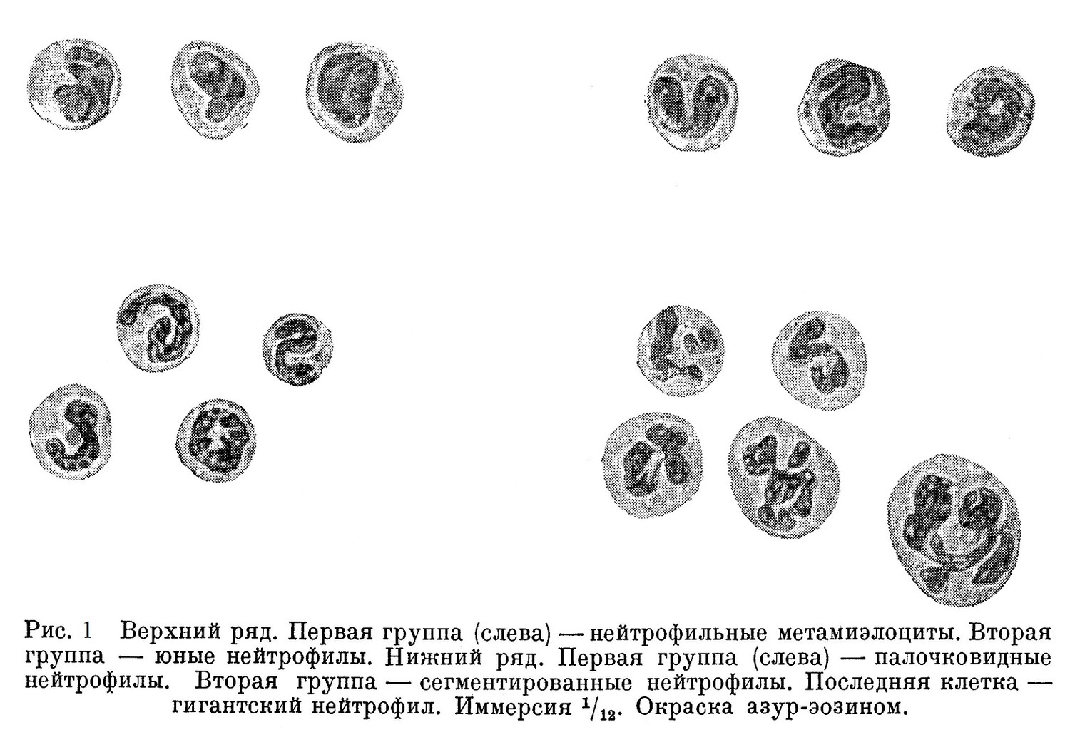 Верхний ряд. Первая группа (слева) — нейтрофильные метамиэлоциты. Вторая группа — юные нейтрофилы. Нижний ряд. Первая группа (слева) — палочковидные нейтрофилы. Вторая группа — сегментированные нейтрофилы. Последняя клетка — гигантский нейтрофил. 
