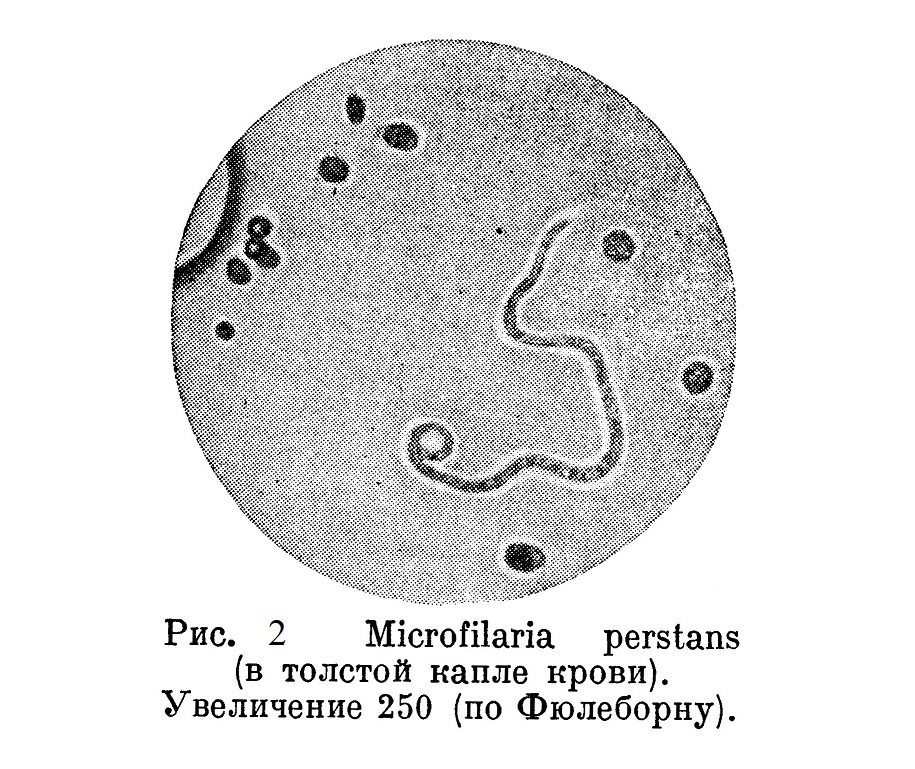 Microfilaria perstans (в толстой капле крови). Увеличение 250 (по Фюлеборну).