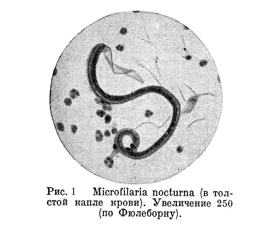 Microfilaria nocturna (в толстой капле крови). Увеличение 250 (по Фюлеборну).