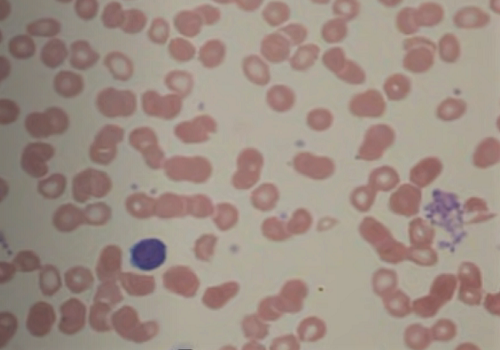 Кровяные пластинки — тромбоциты
