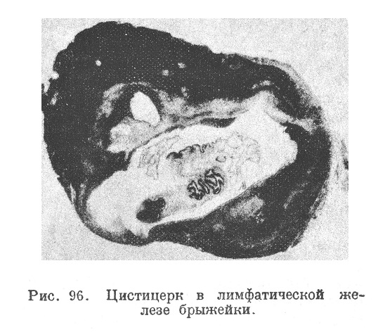 Животные паразиты в лимфатических железах