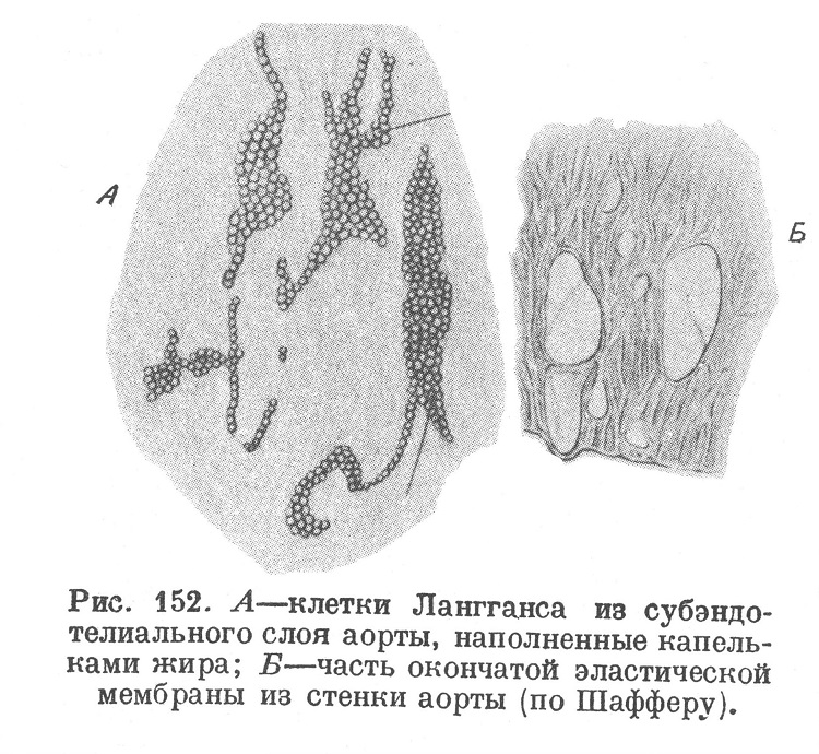 А — клетки Лангганса из субэндотелиального слоя аорты, наполненные капельками жира; В — часть окончатой эластической мембраны из стенки аорты (по Шафферу).