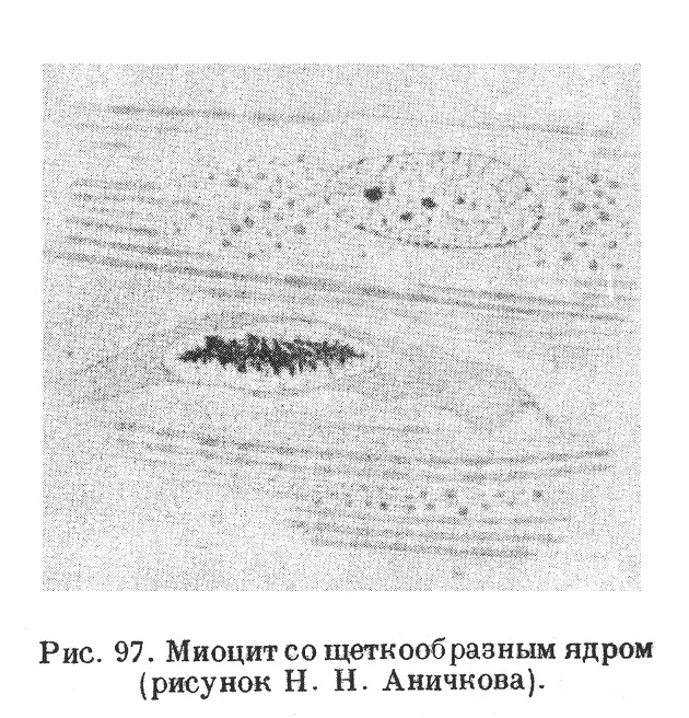 Миоцит со щеткообразным ядром (рисунок Н. Н. Аничкова).