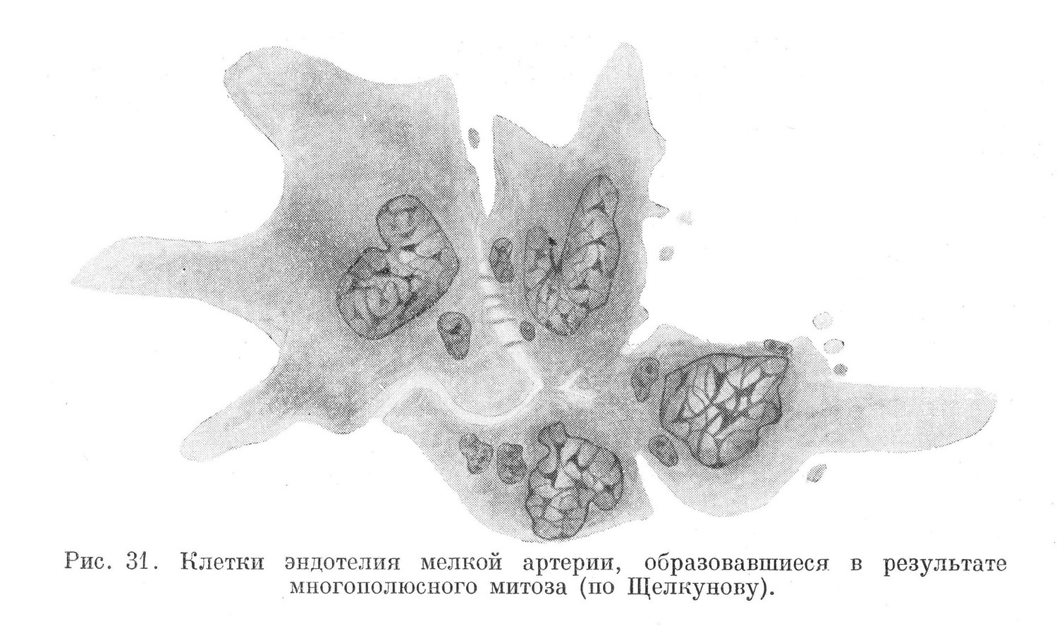 Клетки эндотелии мелкой артерии, образовавшиеся в результате многополюсного митоза (по Щелкунову).