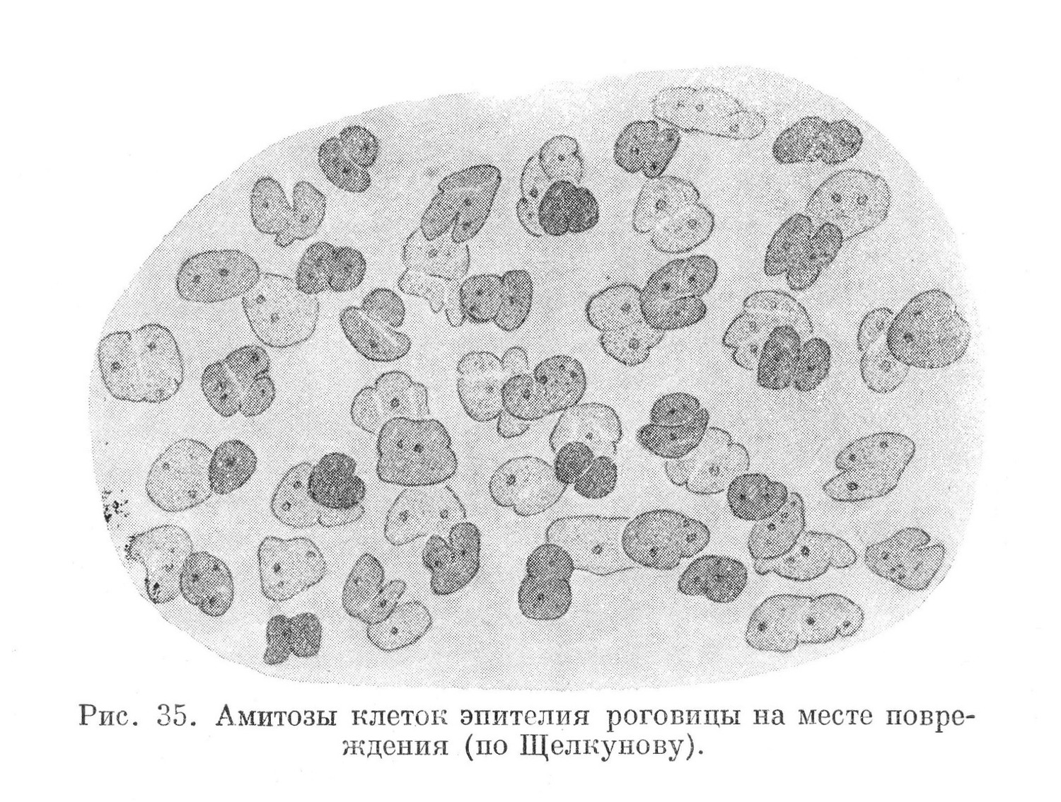 Амитозы клеток эпителия роговицы на месте повреждения (по Щелкунову).