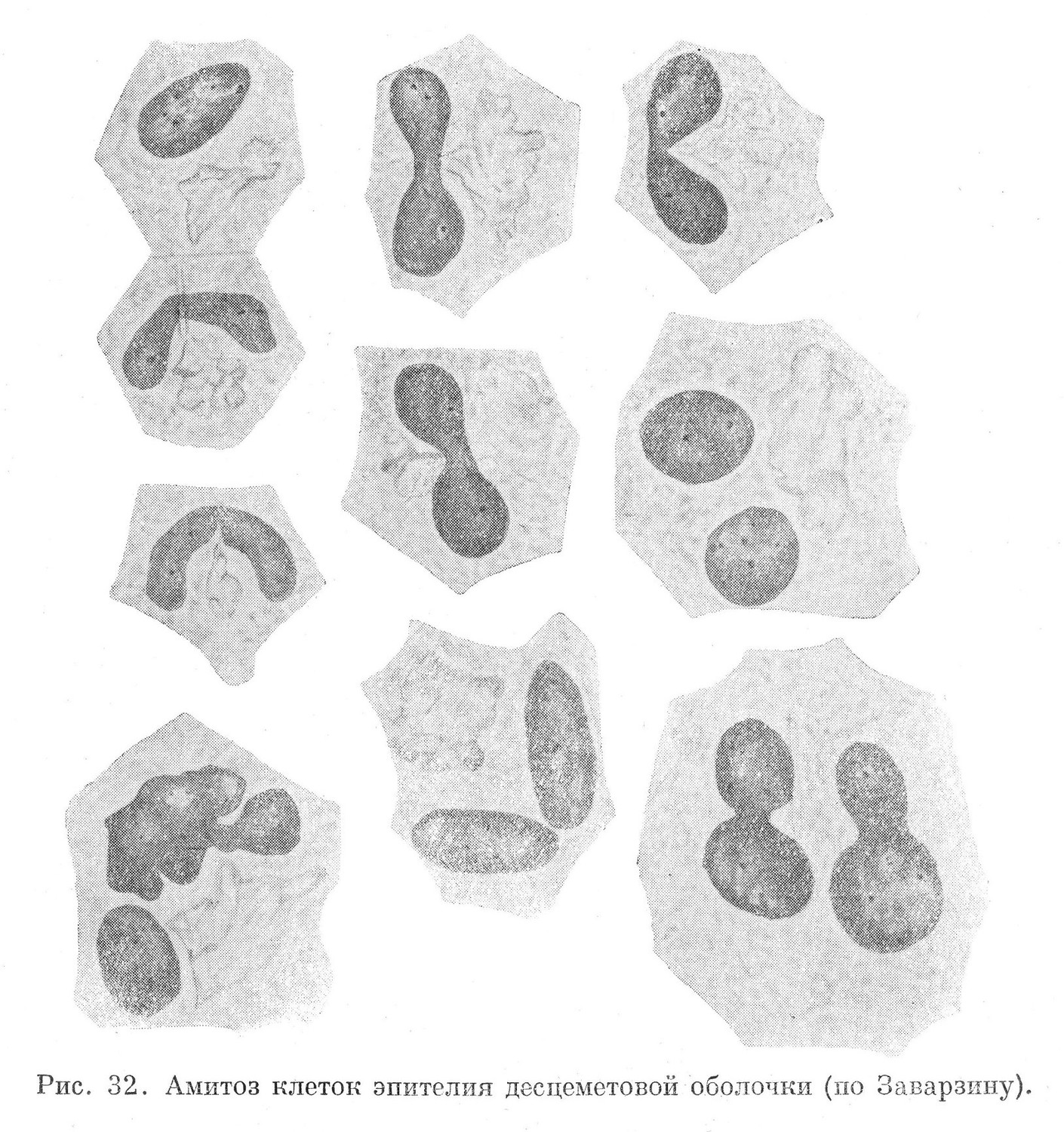 Амитоз клеток эпителия десцеметовой оболочки 